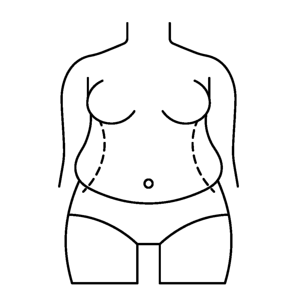 Fat Grafting (Fat Transfer)