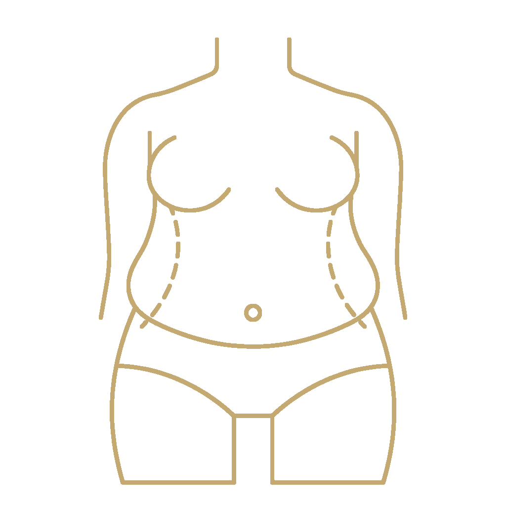 Fat Grafting (Fat Transfer) - procedure illustration