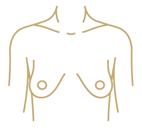 Tuberous Breast Deformity Correction - procedure illustration